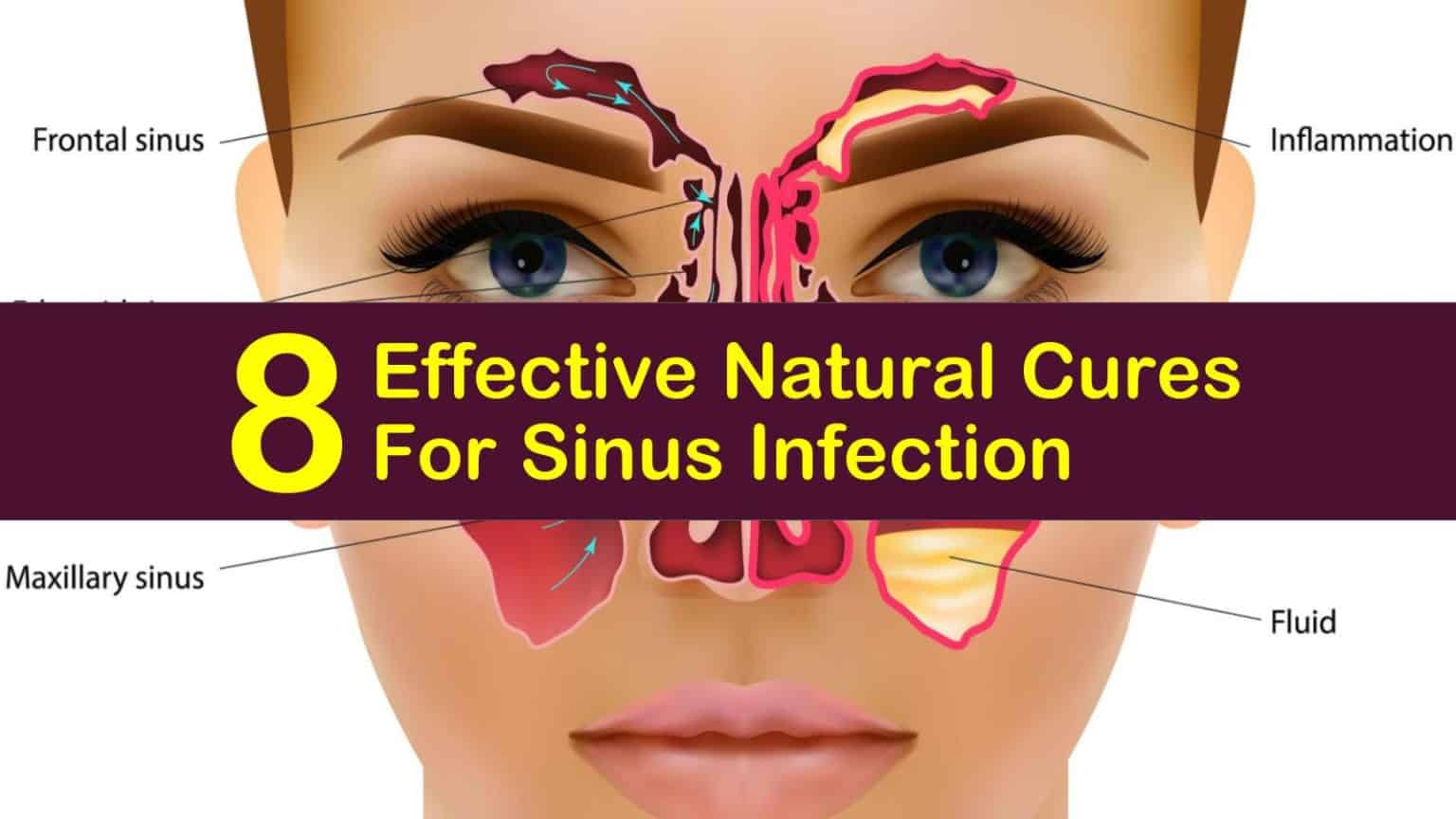 8 Effective Natural Cures For Sinus Infection